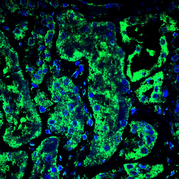 STOM Antibody