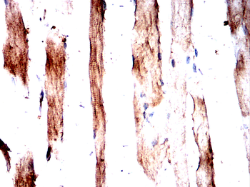 STOM Antibody