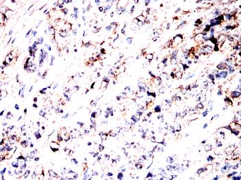 STOM Antibody