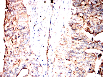 STOM Antibody