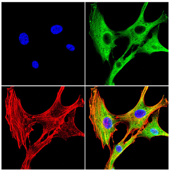 STOM Antibody