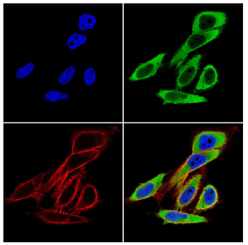 ORM1 Antibody