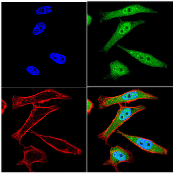IGF2BP3 Antibody