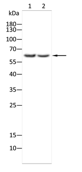 IGF2BP3 Antibody