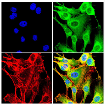 IGF2BP3 Antibody