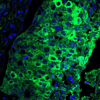 IGF2BP3 Antibody