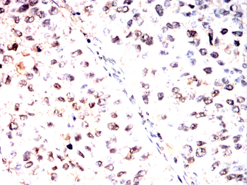 IGF2BP3 Antibody