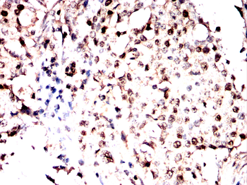 IGF2BP3 Antibody