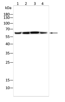 IGF2BP3 Antibody