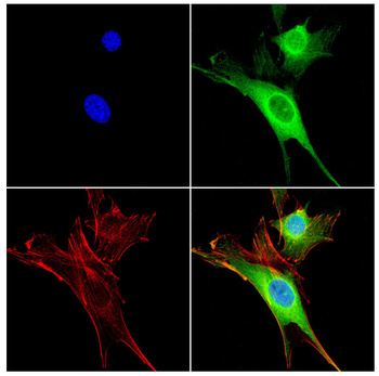 NR3C1 Antibody