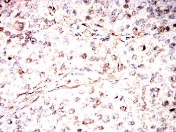 NR3C1 Antibody