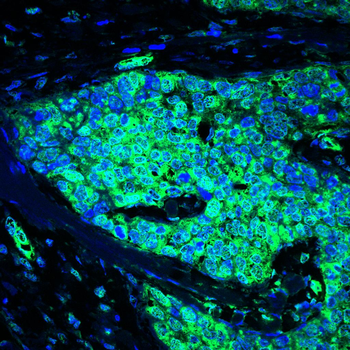 NR3C1 Antibody
