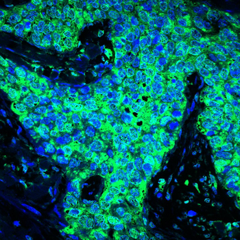 NR3C1 Antibody