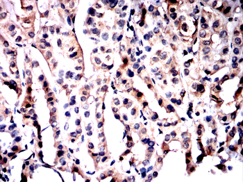 NR3C1 Antibody