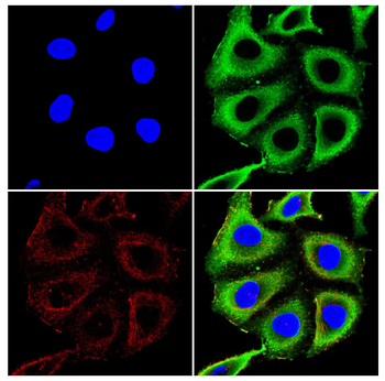 NFKB2 Antibody