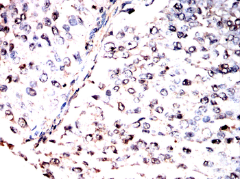 NFKB2 Antibody