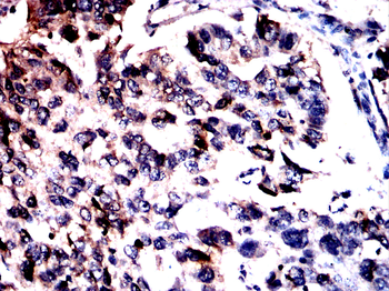 NFKB2 Antibody