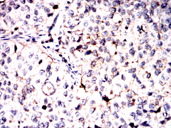 NFKB2 Antibody