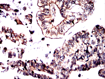 NFKB2 Antibody