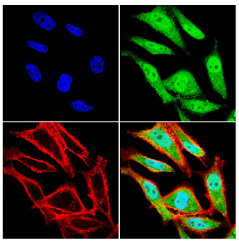 YTHDF2 Antibody