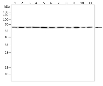YTHDF2 Antibody
