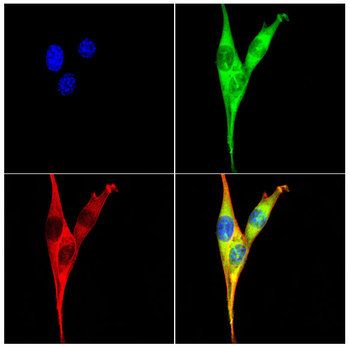 YTHDF2 Antibody