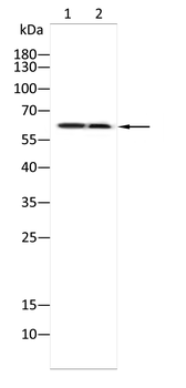 YTHDF2 Antibody