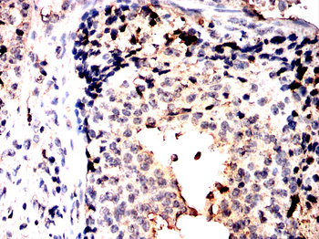 POU4F1 Antibody