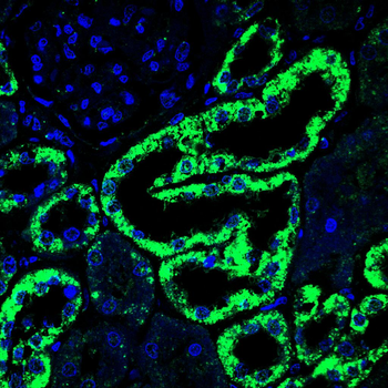 DLAT Antibody