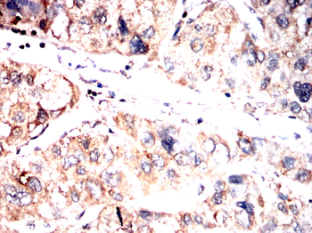 DLAT Antibody