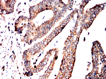 DLAT Antibody