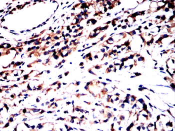 DLAT Antibody