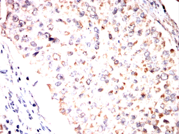 DLAT Antibody