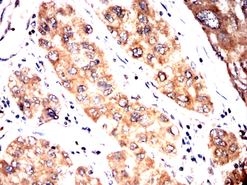 PRDM16 Antibody