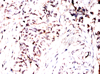 PRDM16 Antibody