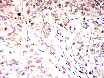 PRDM16 Antibody