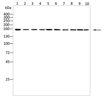 PRDM16 Antibody