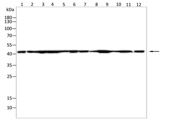 ACTB Antibody