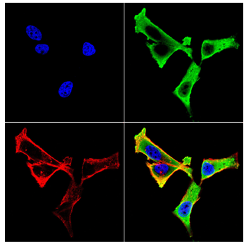 CTHRC1 Antibody