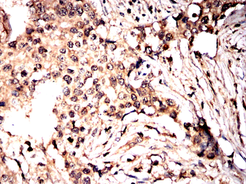 CTHRC1 Antibody