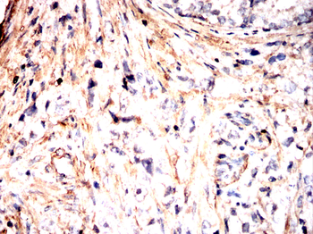CTHRC1 Antibody