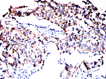 CTHRC1 Antibody
