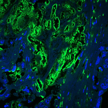 CTHRC1 Antibody
