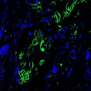 CTHRC1 Antibody
