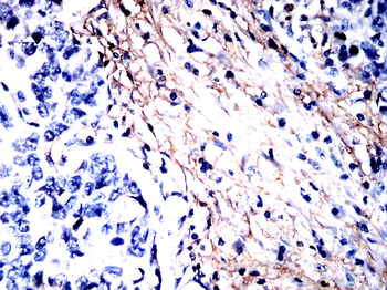 CTHRC1 Antibody