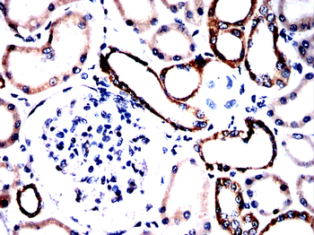 CTHRC1 Antibody