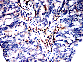 CTHRC1 Antibody