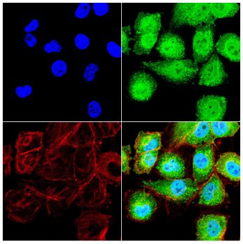 YBX2 Antibody