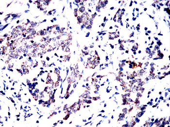 YBX2 Antibody
