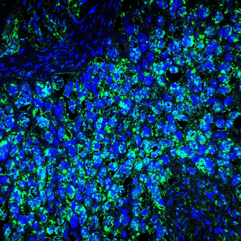 YBX2 Antibody